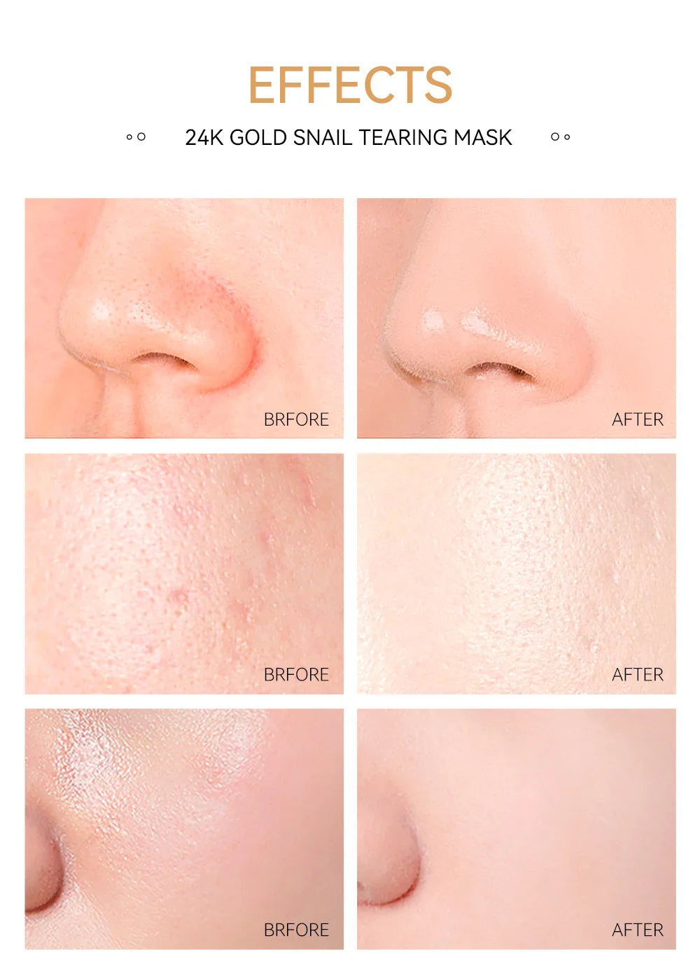 Masque Anti-Points Noirs Or