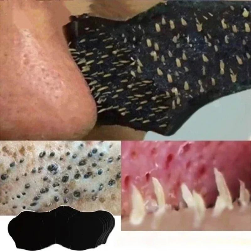 Patch Nasal Anti Points Noirs