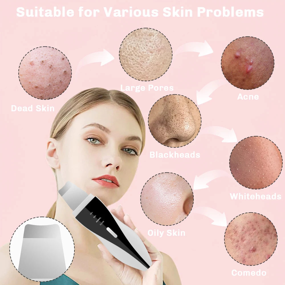 Épurateur de peau à Ultrasons